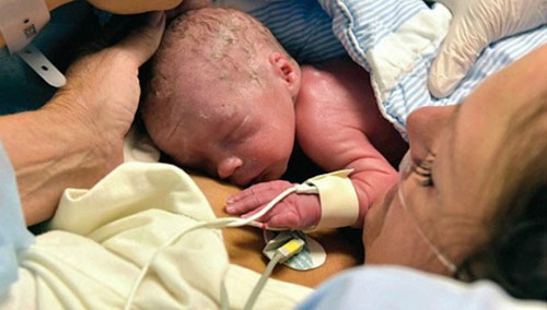 Сенсационный случай: женщина родила после пересадки матки