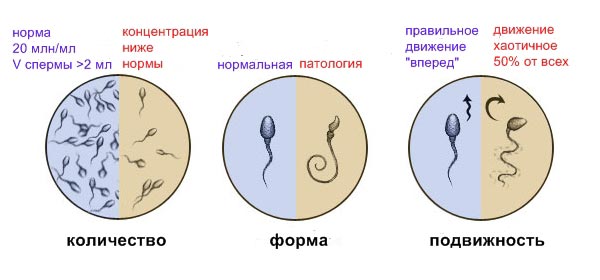 Состояние эякулята (спермограмма)